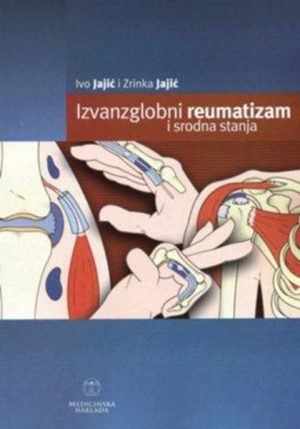 IZVANZGLOBNI REUMATIZAM I SRODNA STANJA
