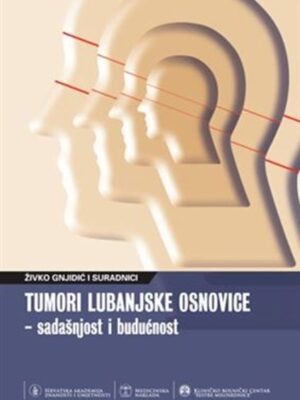 TUMORI LUBANJSKE OSNOVICE