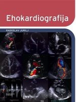 EHOKARDIOGRAFIJA