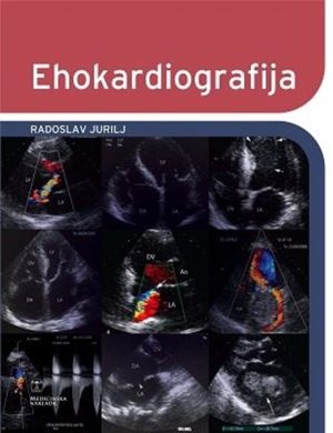 EHOKARDIOGRAFIJA