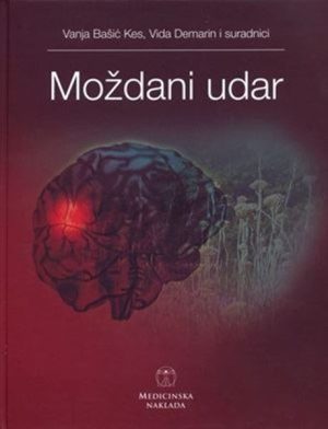 MOŽDANI UDAR