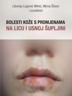 Bolesti kože s promjenama na licu i usnoj šupljini