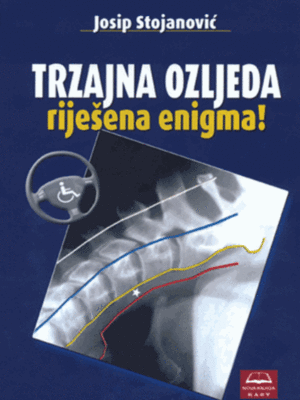 TRZAJNA OZLJEDA - RJEŠENA ENIGMA!