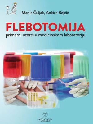Flebotomija