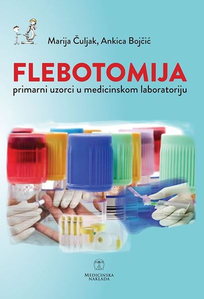 Flebotomija