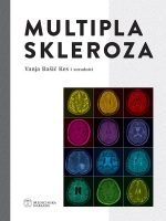 MULTIPLA SKLEROZA