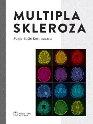 MULTIPLA SKLEROZA