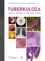 TUBERKULOZA - stara dama u novom ruhu