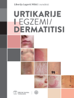 URTIKARIJE I  EGZEMI/ DERMATITISI