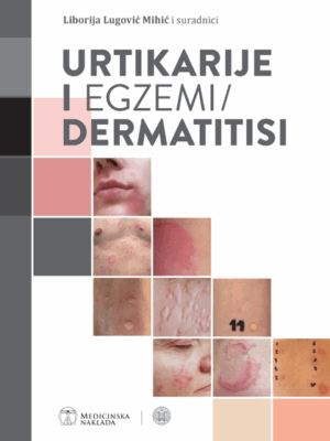 URTIKARIJE I  EGZEMI/ DERMATITISI