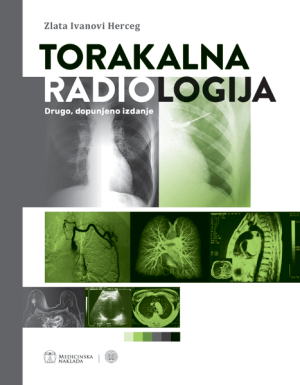 TORAKALNA RADIOLOGIJA