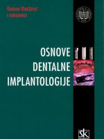 Osnovi dentalne implantologije