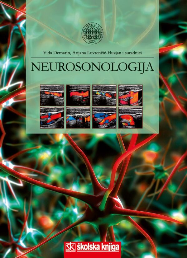 NEUROSONOLOGIJA