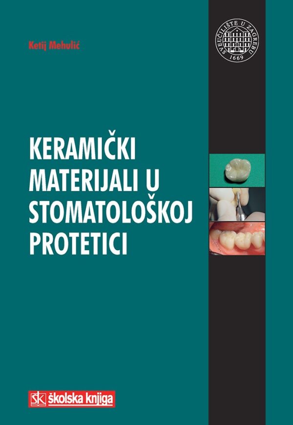 Keramički materijali u stomatološkoj protetici