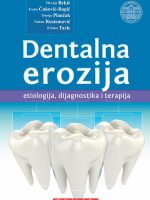 Dentalna erozija