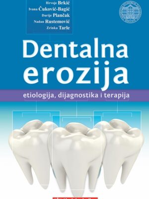 Dentalna erozija
