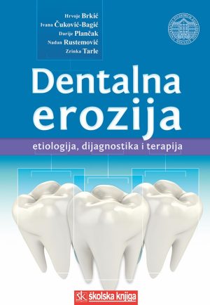 Dentalna erozija