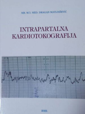 Intrapartalna kardiotokografija