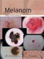 Melanom-udžbenik i atlas