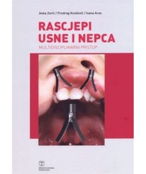 Rascjepi usne i nepca
