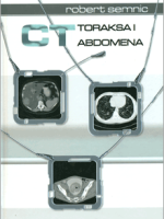 CT TORAKSA I ABDOMENA