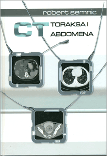 CT TORAKSA I ABDOMENA