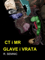 CT i MR glave i vrata