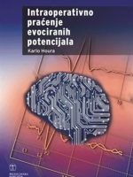INTRAOPERATIVNO PRAĆENJE EVOCIRANIH POTENCIJALA