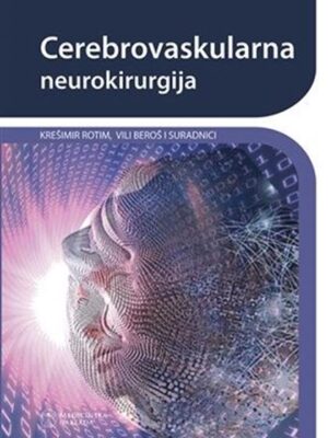 Cerbovaskularna neurokirurgija
