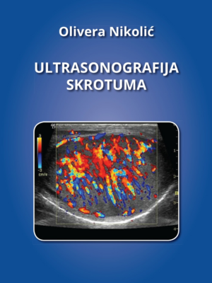 Ultrasonografija skrotuma