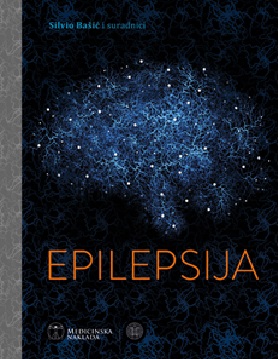 Epilepsija